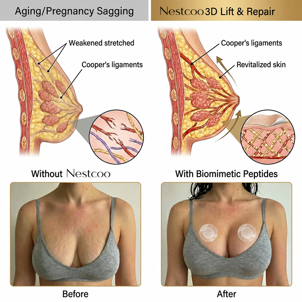 Bust Firming Microneedle Patches for Skin and Shape Support