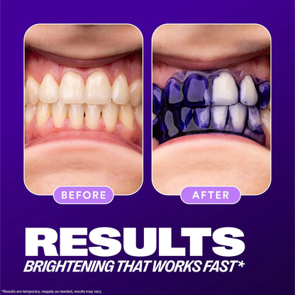 Purple Tooth Colour Corrector for Temporary Stain Concealing and Brightening