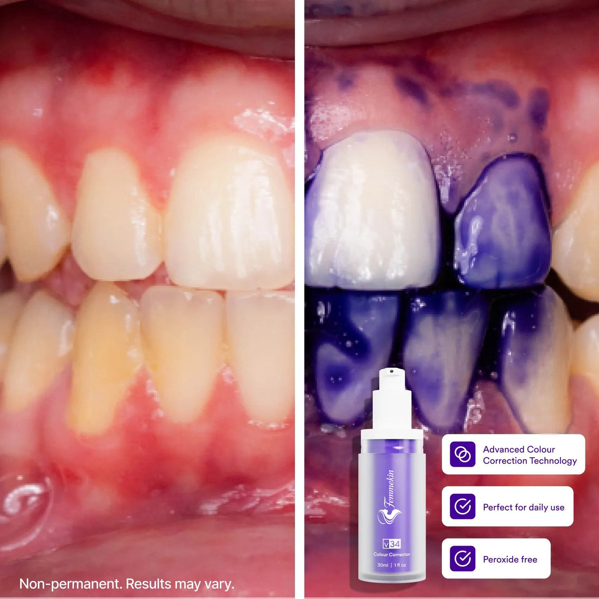 Purple Tooth Colour Corrector for Temporary Stain Concealing and Brightening